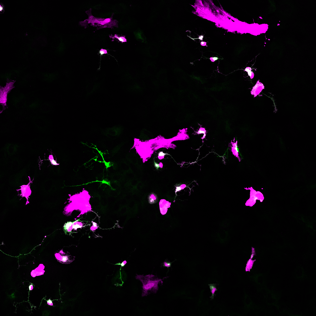 MG_73 P13 Ascl1 4-5 div 8dpTF mir-25 RFP Map2 Otx2 2  SW reprog.png