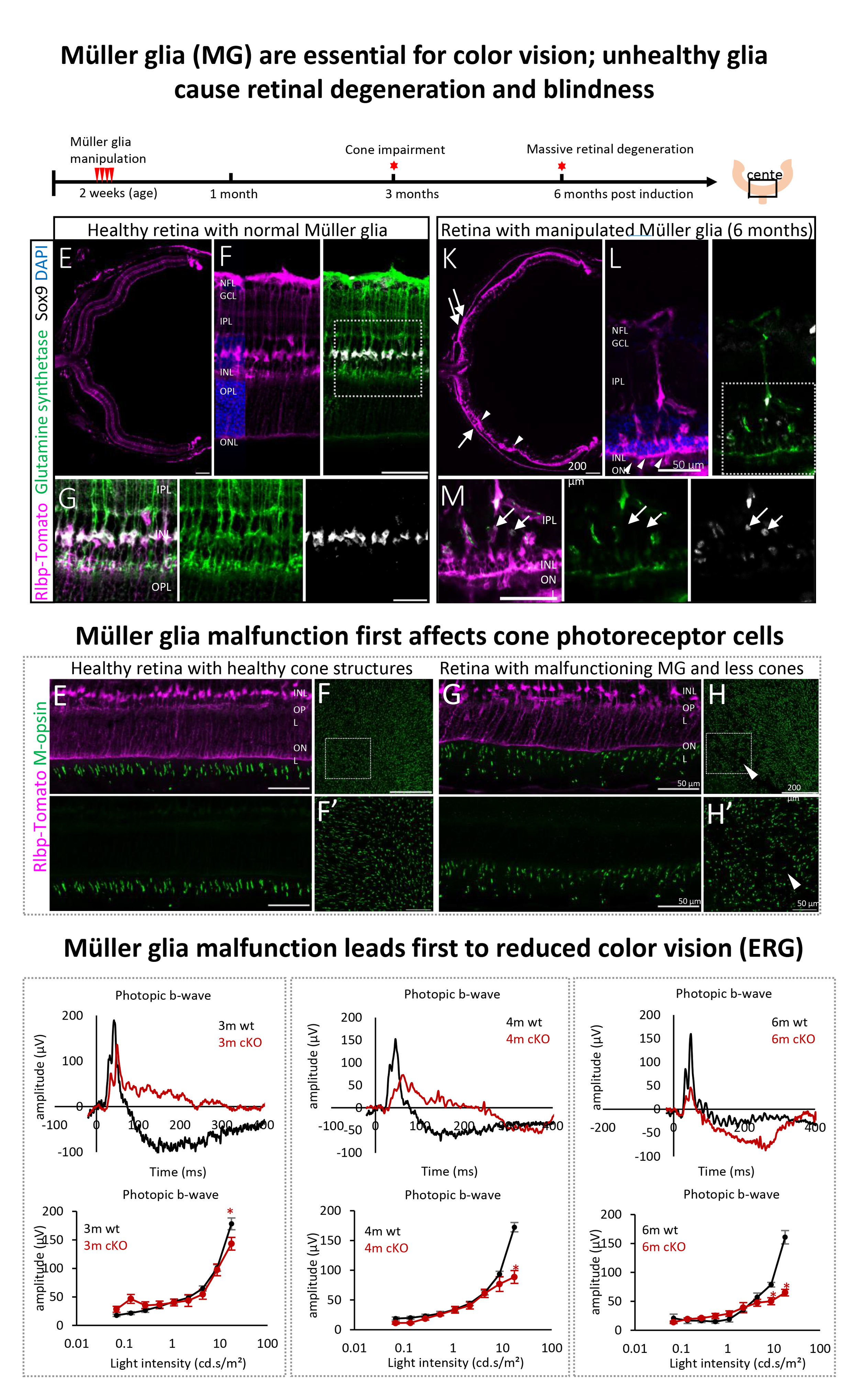 Histology and electroretinography of normal retinas and retinas with manipulated Muller glia.