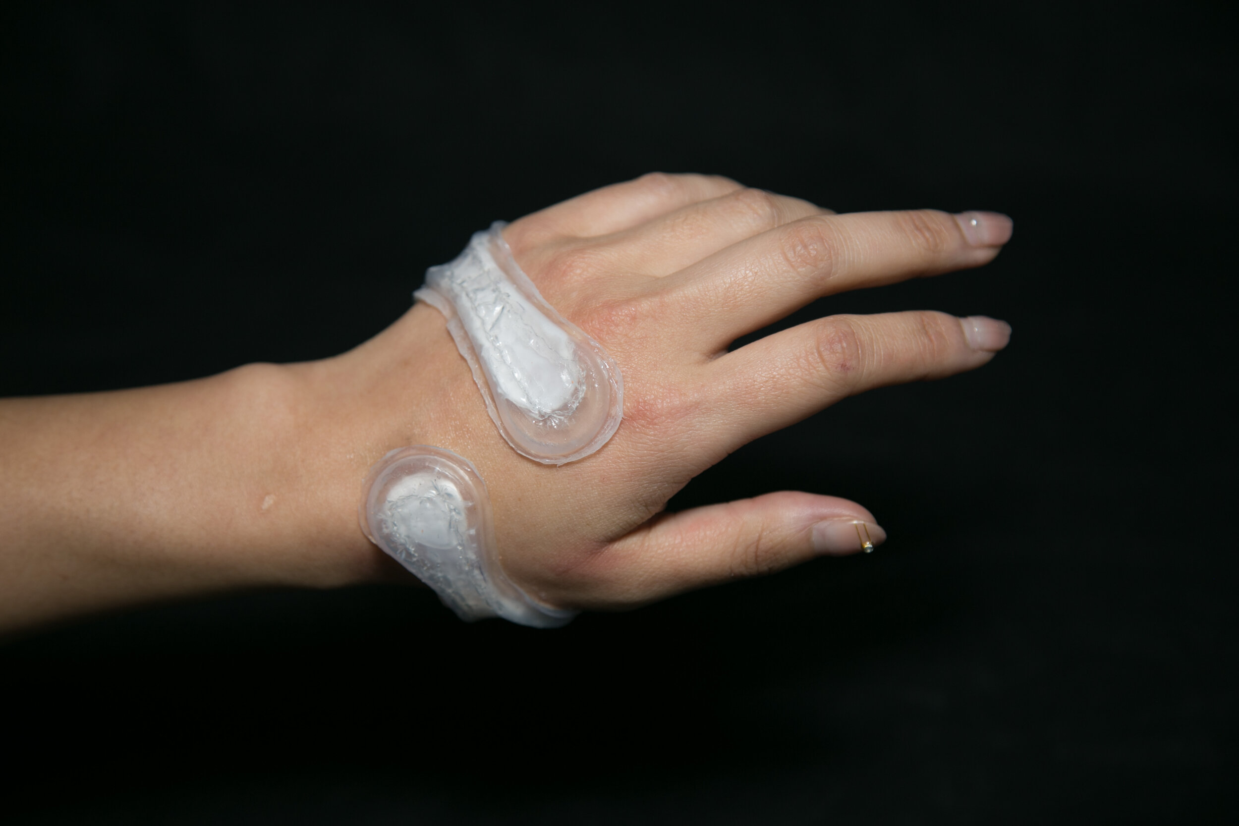  An interactive carpel tunnel splint for rehabilitation in activated state 