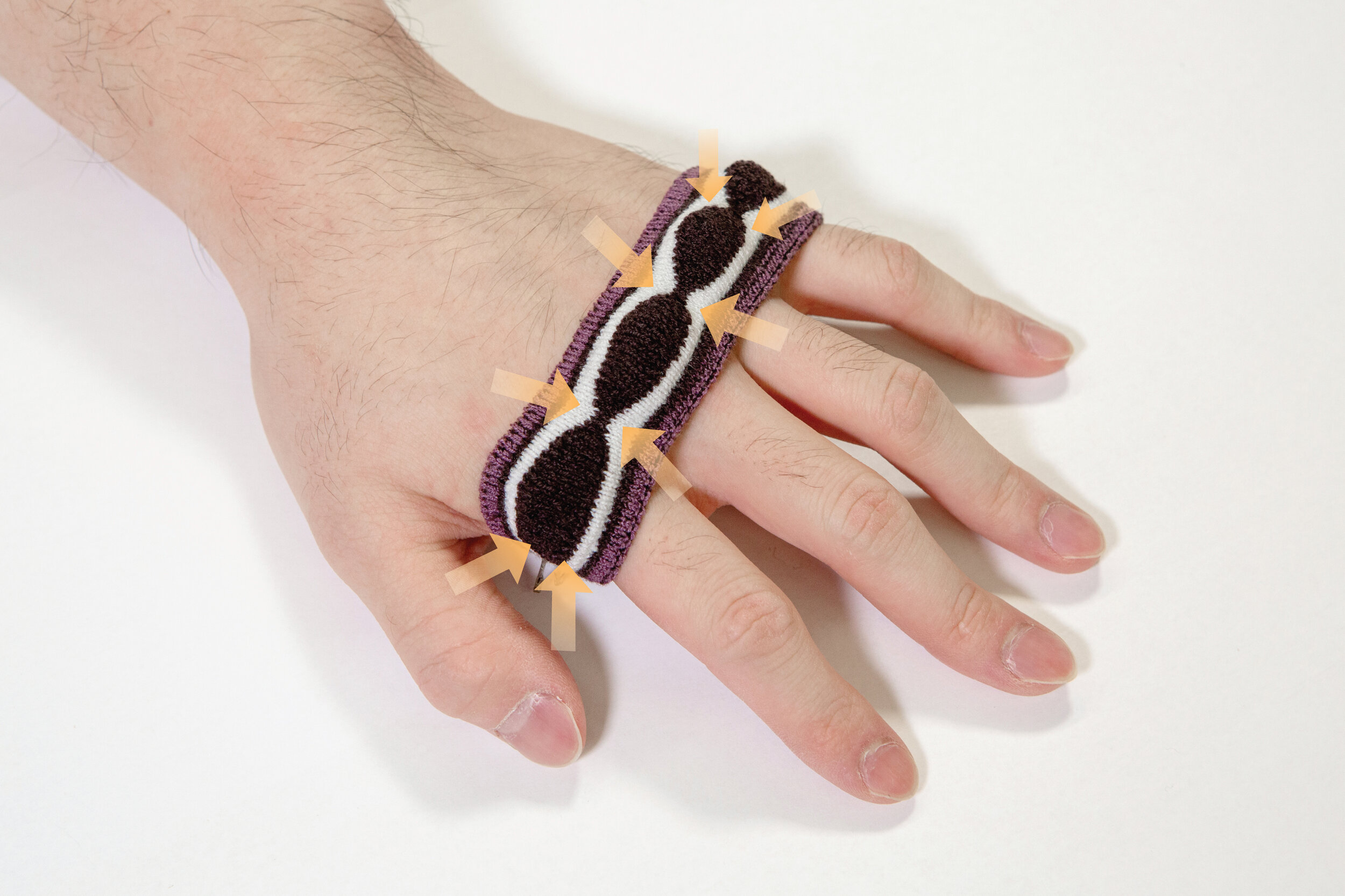  KnitDermis on-body interfaces deliver expressive tactile feedback on the wearer’s body. Fabricated through machine knitting, they embed shape-memory alloy micro-springs in knitted channels, which deliver tactile sensations on the skin when activated