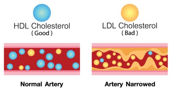 Cholesterol.jpg