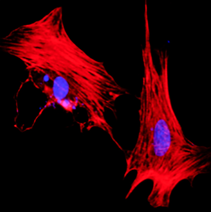 Cardiomyocytes.jpg