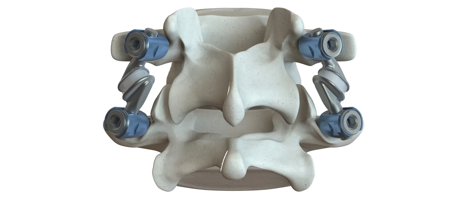 FM_posterior_withdisc.jpg