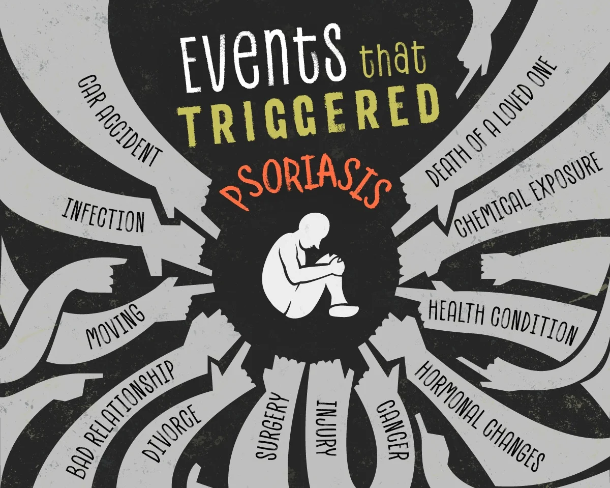 Courtesy of plaquepsoriasis.com