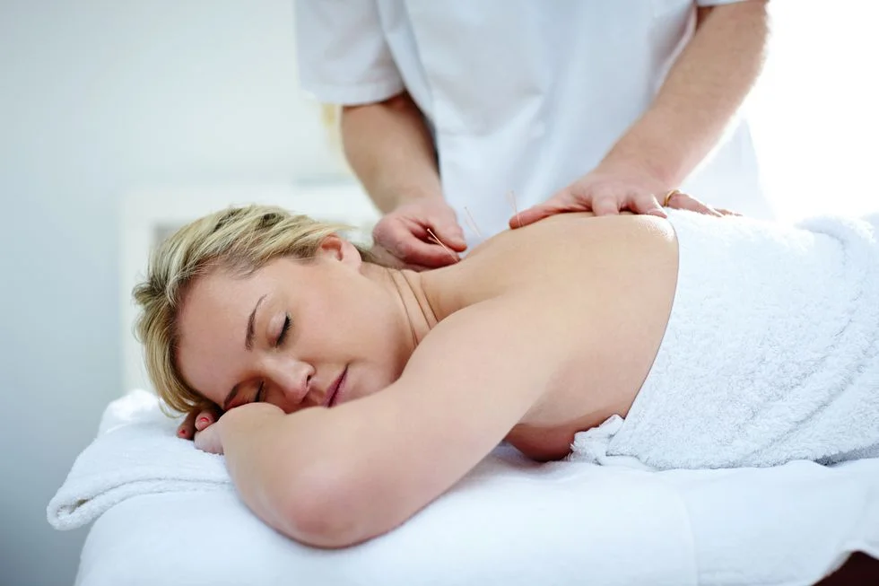 acupuncture-1548154837.jpg