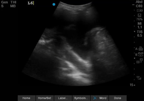 Interactive POCUS Cases — UBC IM POCUS