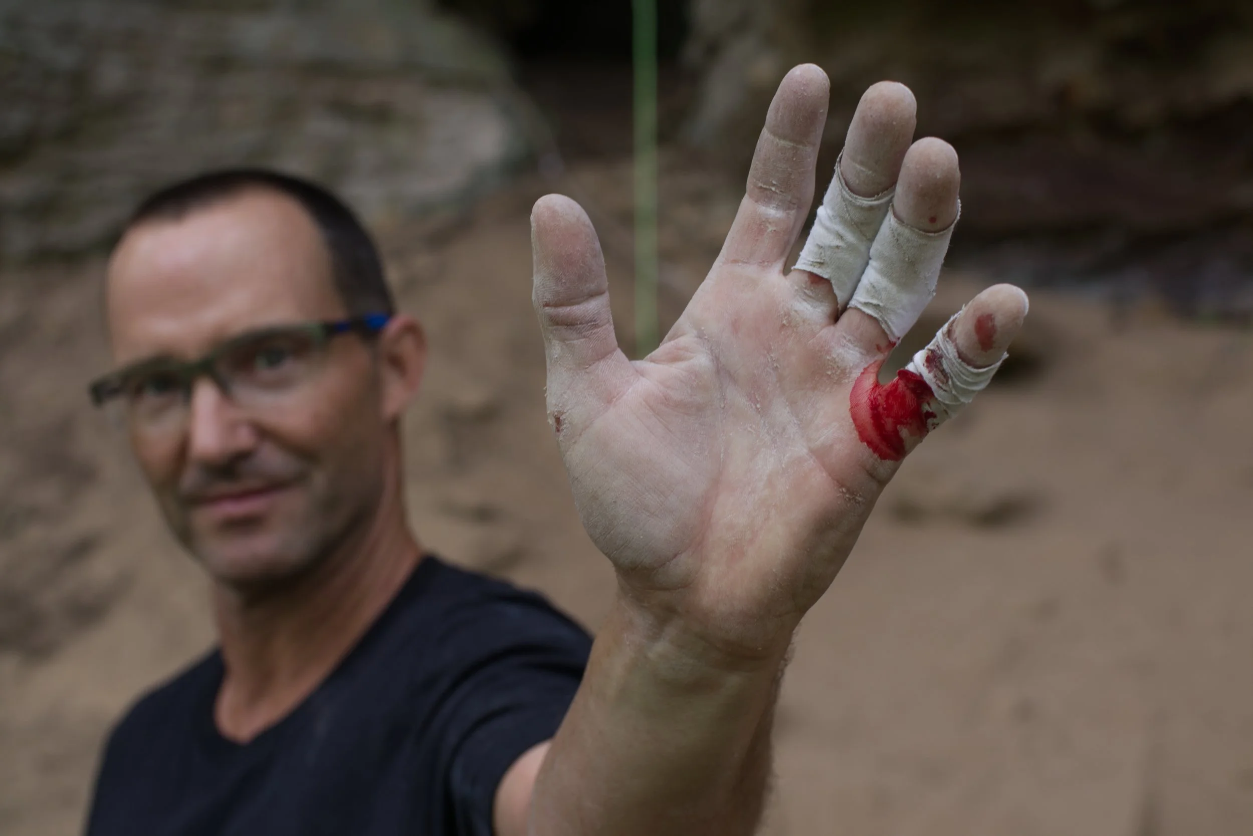 bills hand.jpg