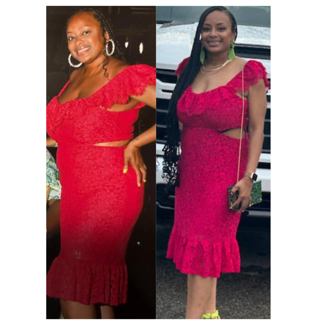 Koya Before AFter.png