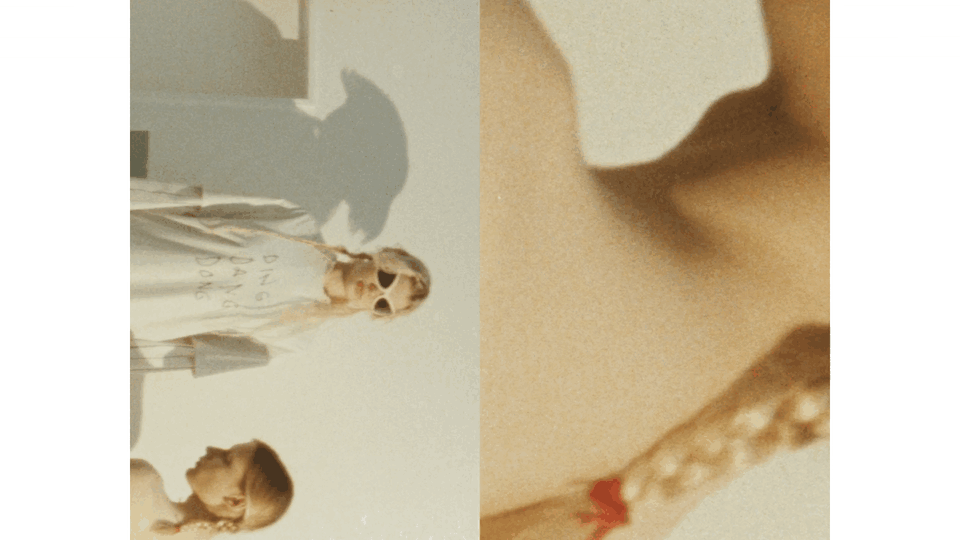 ACNE_W_01_00000000.gif