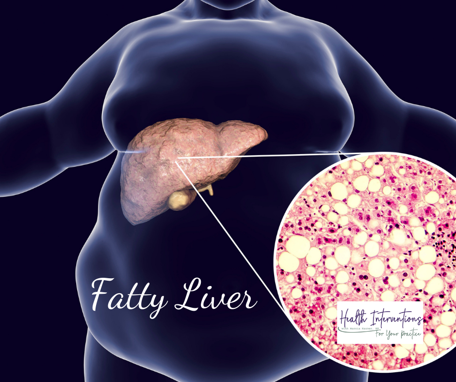 Episode #18 Why is Fatty Liver Such a Big Deal?