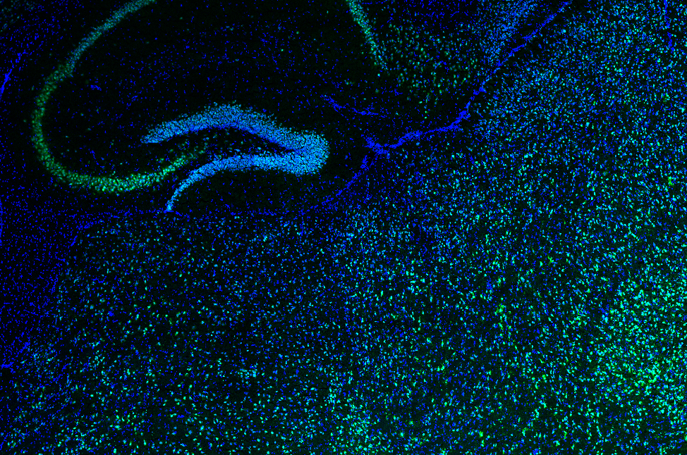 Courtney Whilden receives Simmons Award from the Harvard Center for Biological Imaging