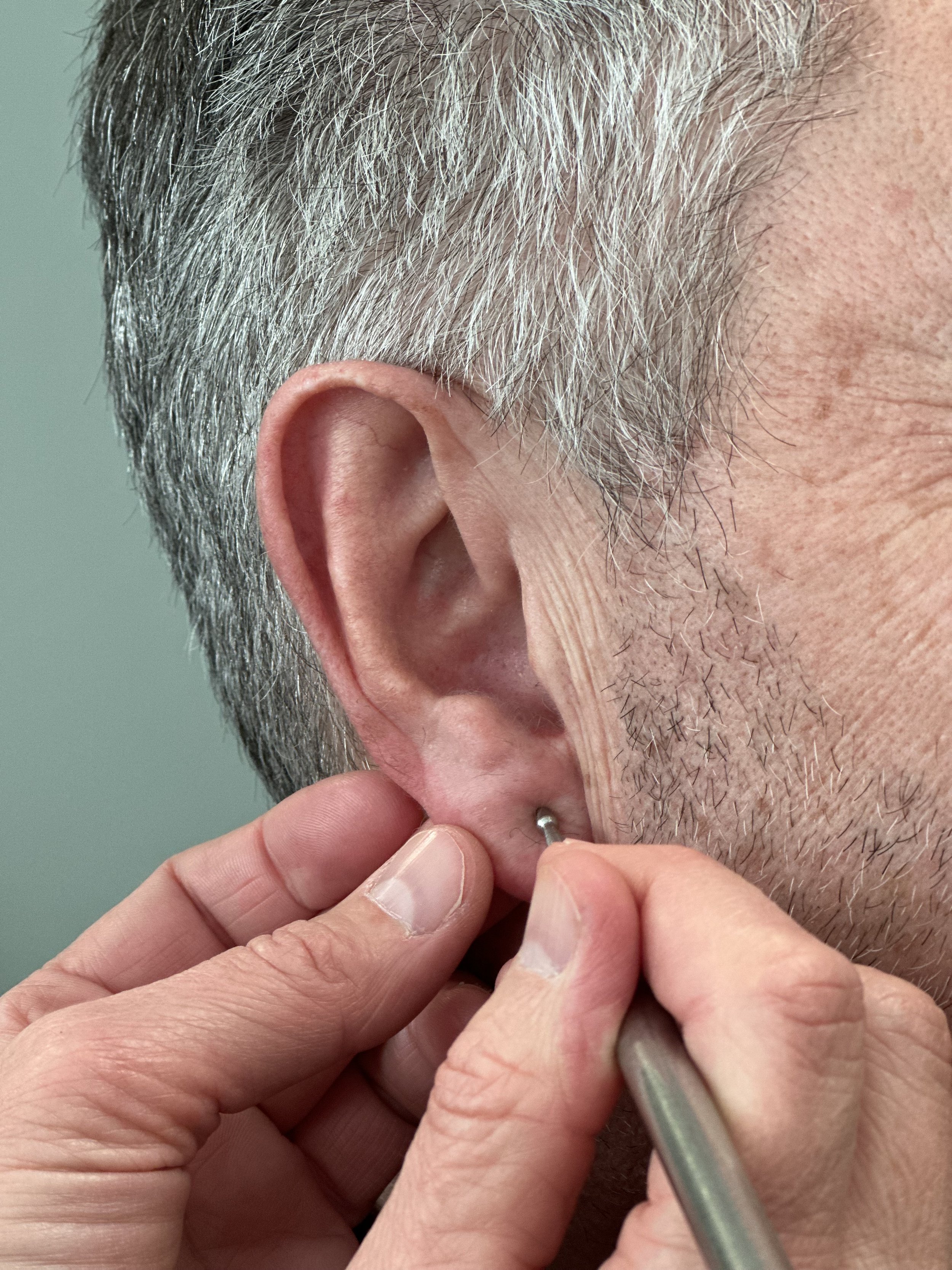 ØREAKUPUNKTUR FORDYPNINGSKURS