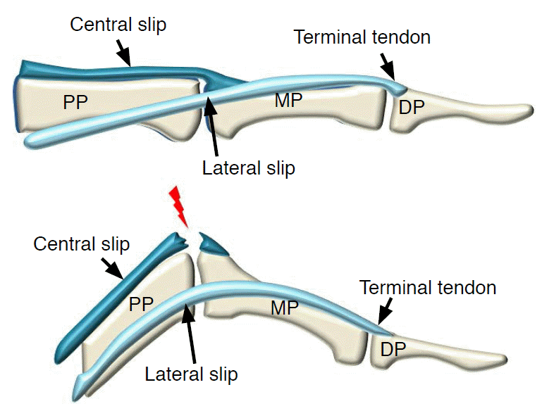 Blog | Set in Motion Physiotherapy
