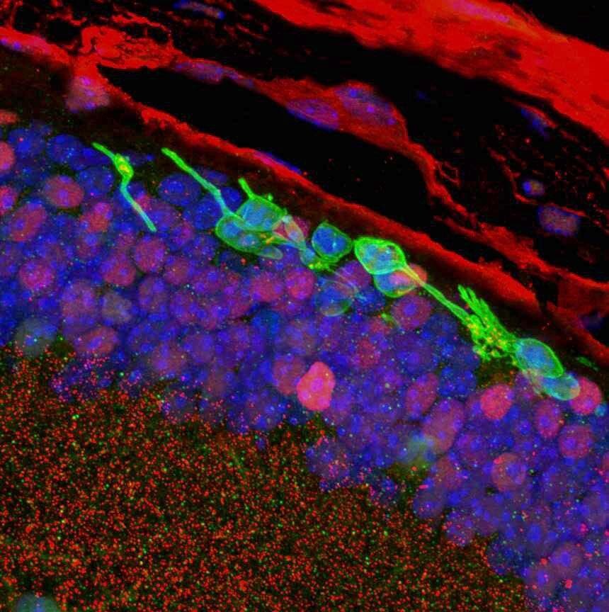 PICTURED: Histology cross-section of the retina. Transplanted CiPCs (green) survive in blind mice (rd1) 3 months after transplantation. Photo credit: Sai Chavala.