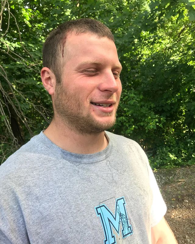 Mushtopia Injuries  @tombrady  Mushmaster.com for this mush shirt.  #mushshotguns  #mushinjury  #mushlight