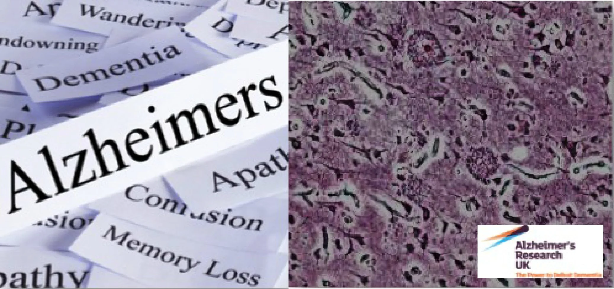 AlzheimersImage.jpg