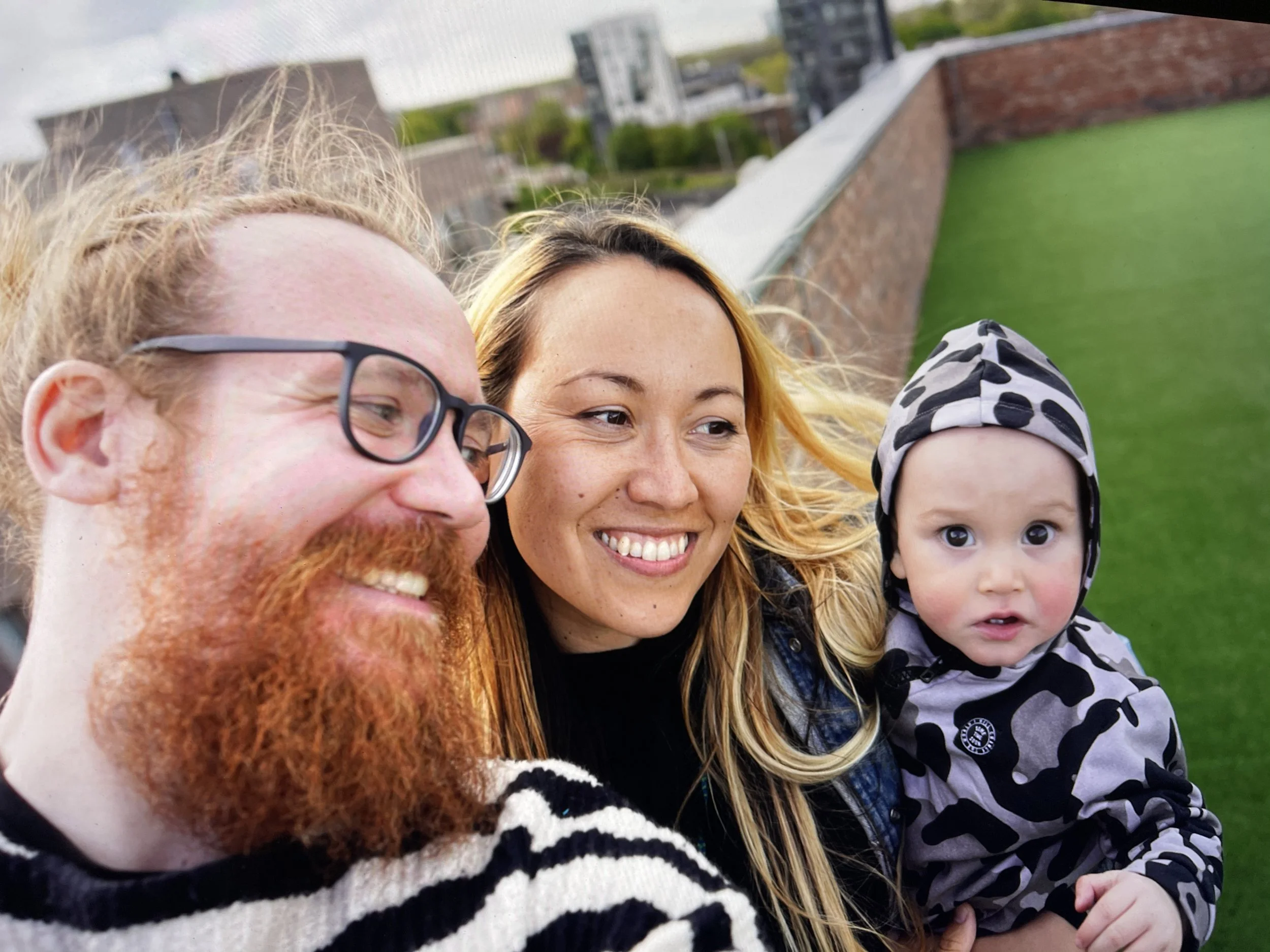 Parents Say They are not Given Adequate Support to Cope with Children's Allergies