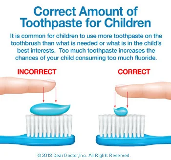 correct-amount-of-toothpaste-thumb.jpg