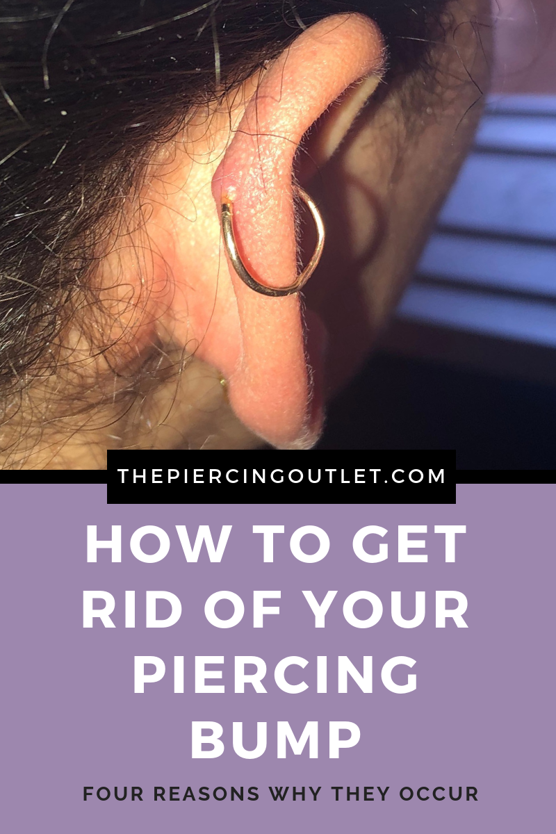 Keloid Infected Cartilage Piercing Treatment Cartilage Piercing