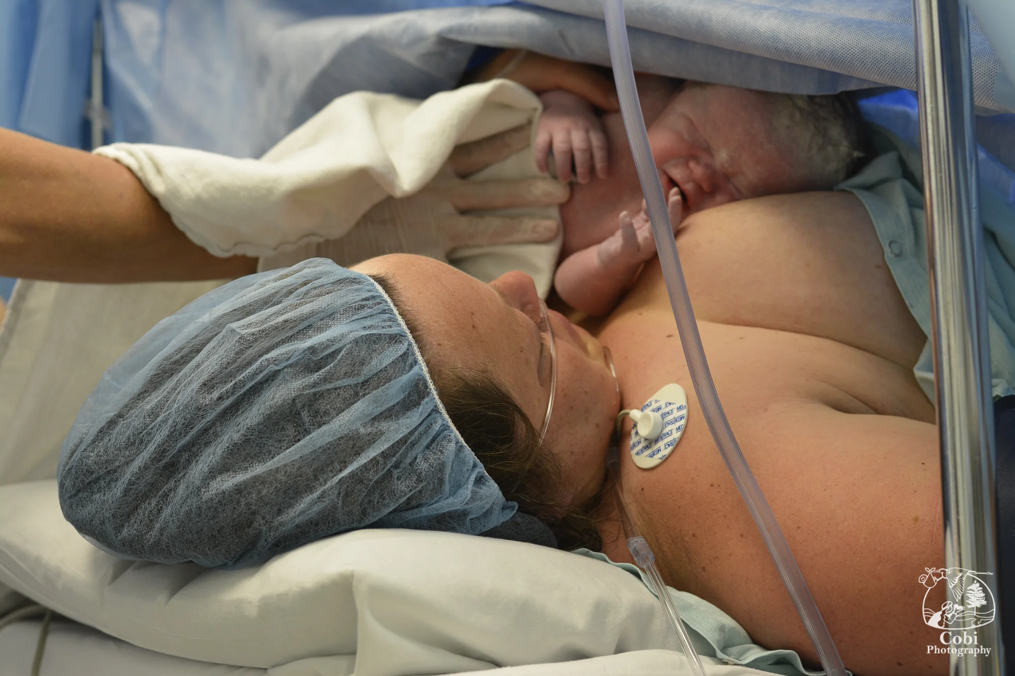 Cesarean birth at hospital in Huntsville.