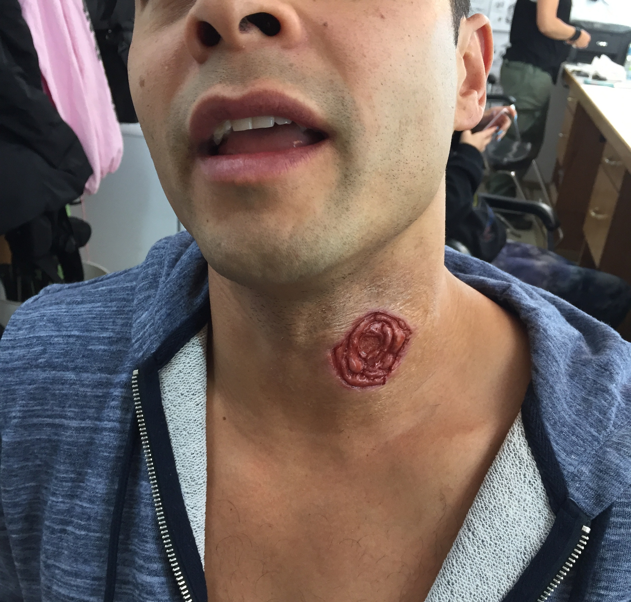  Small version prosthetic build for El Chicano. 