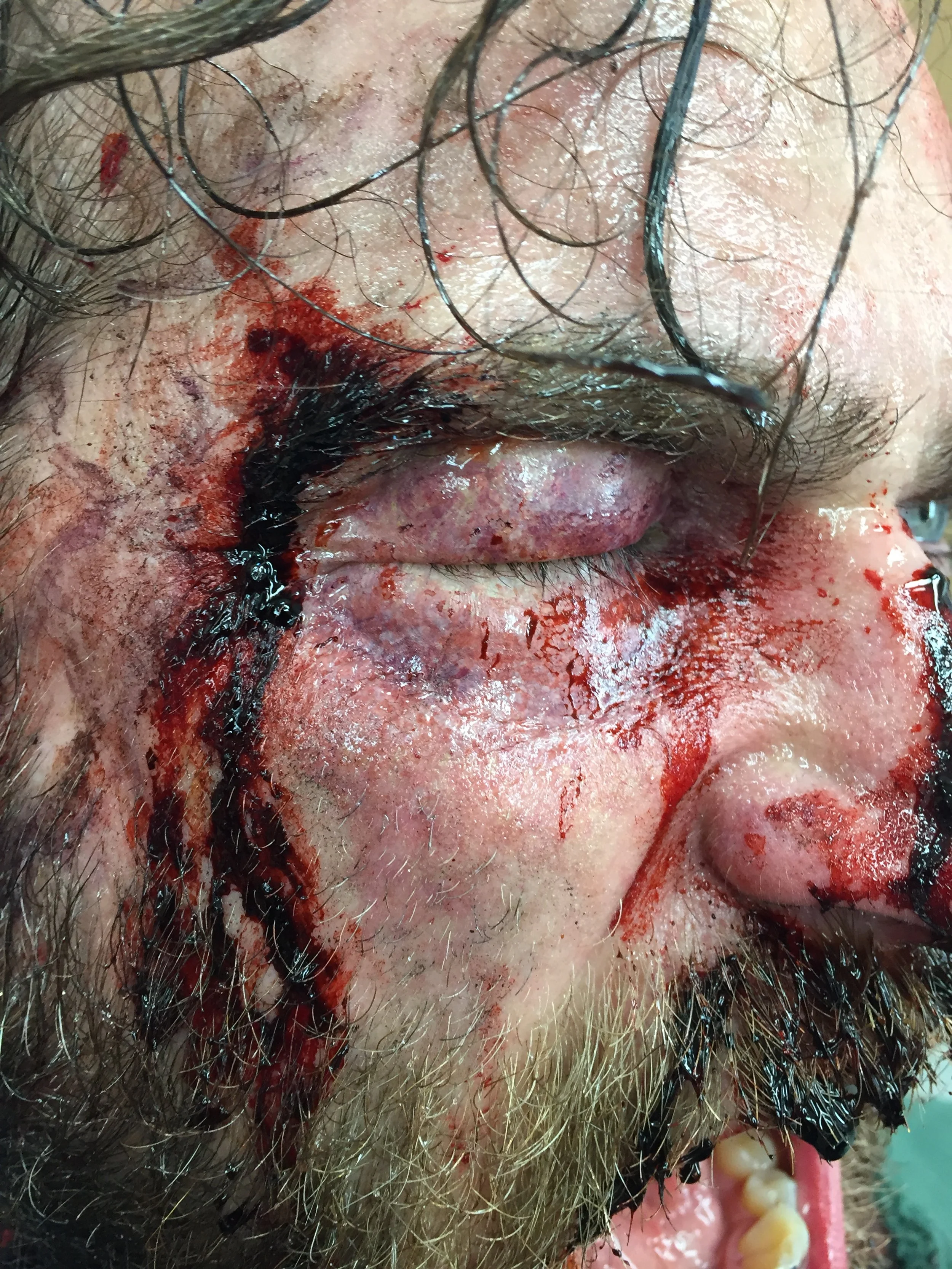  Silicone application on Black Summer S2. 