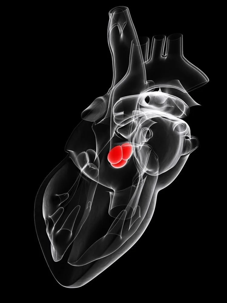 What is Mitral Regurgitation or Leaky Mitral Valve mean?