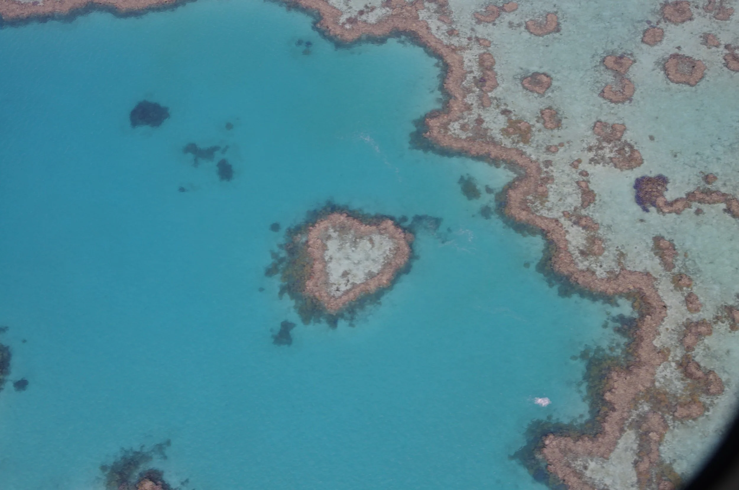 What is Heart Failure (CHF)?