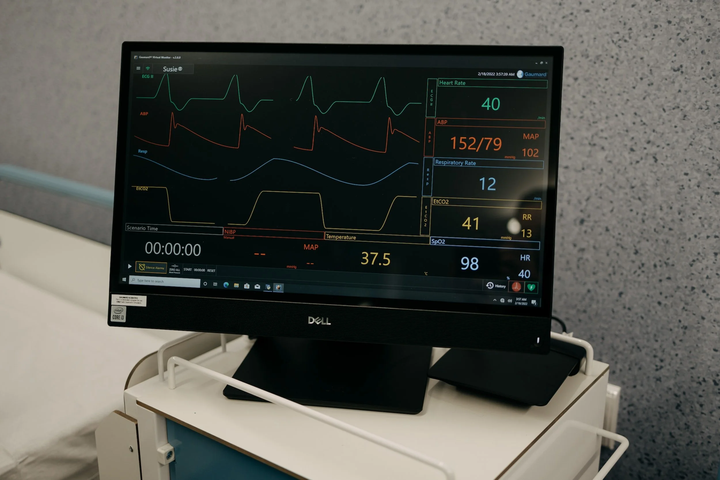 What is an Event Monitor?