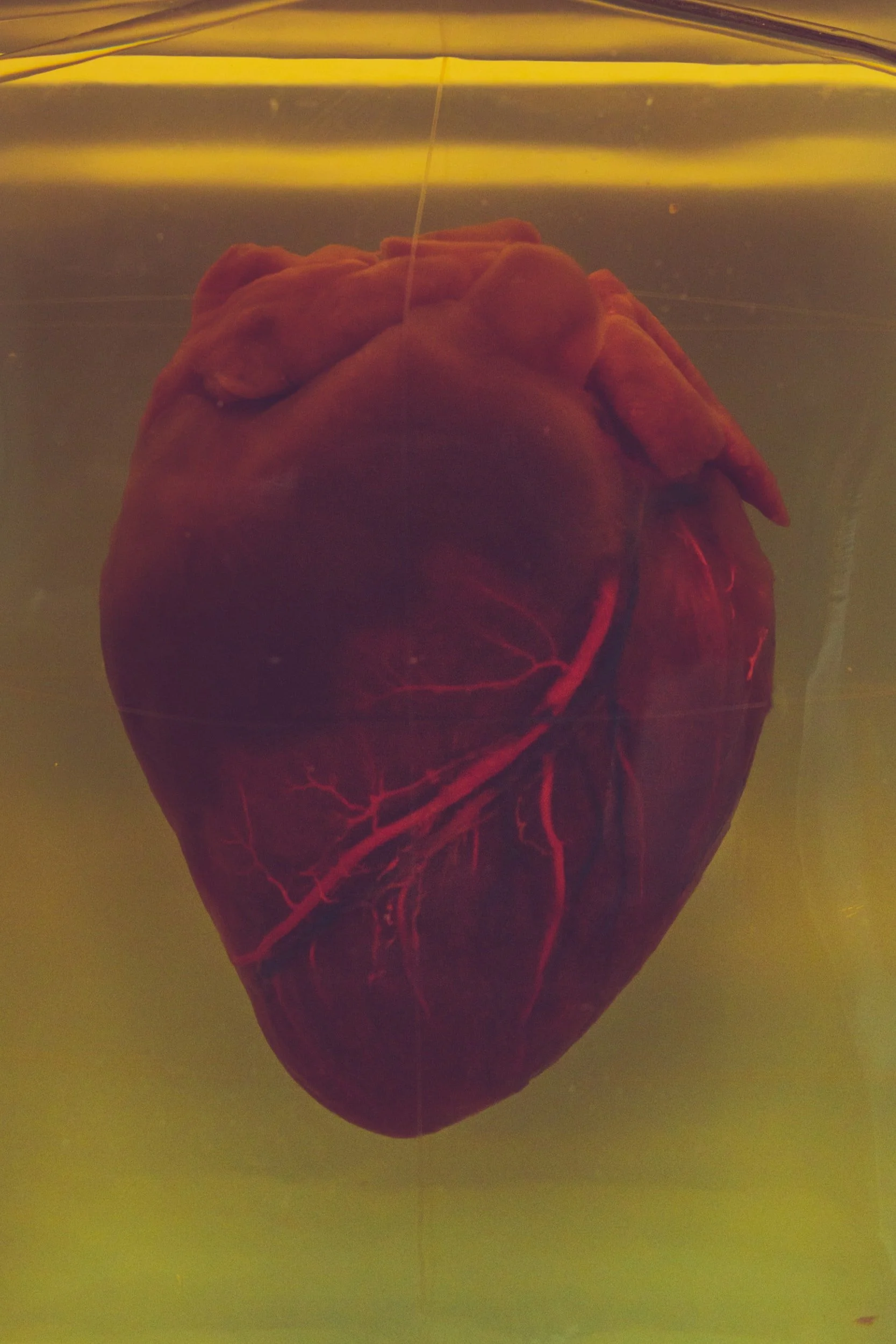 What are Heart Valves?