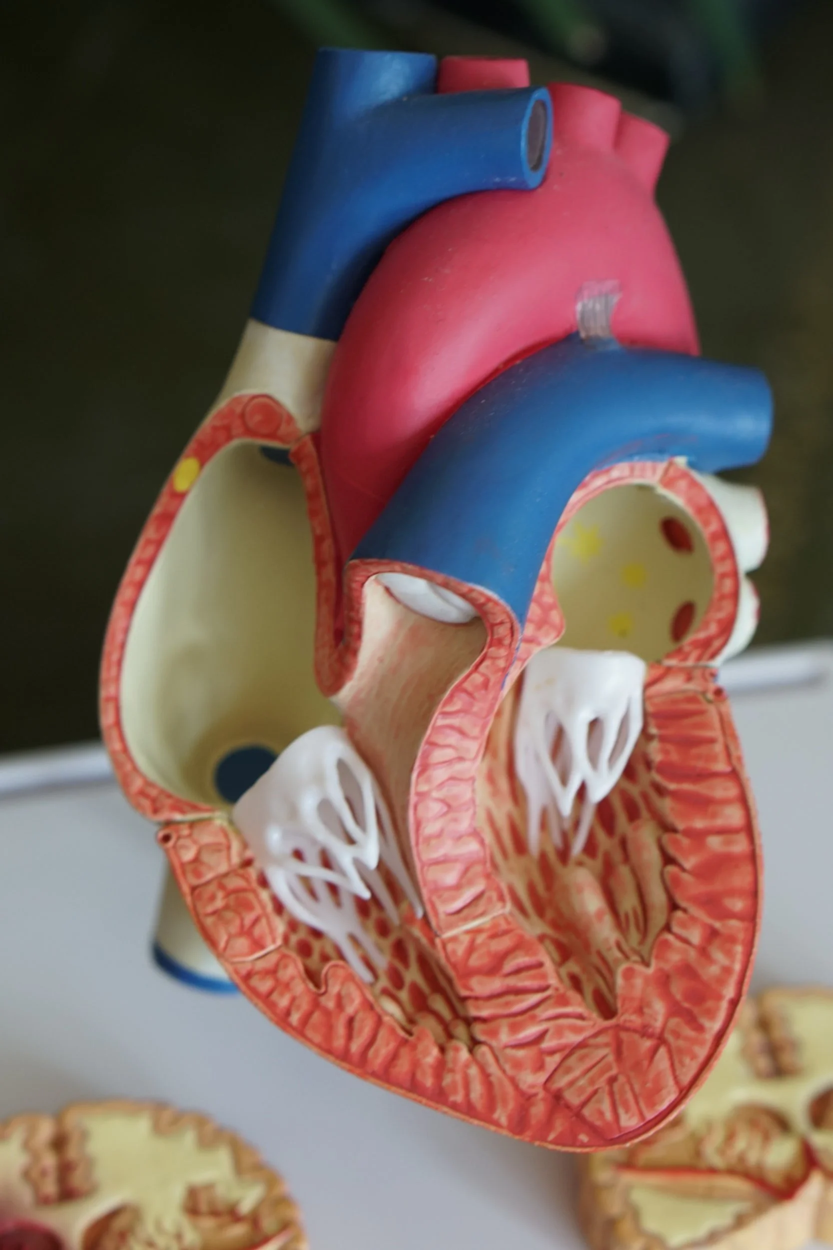 Spontaneous Coronary Artery Dissection - Am I at Risk?