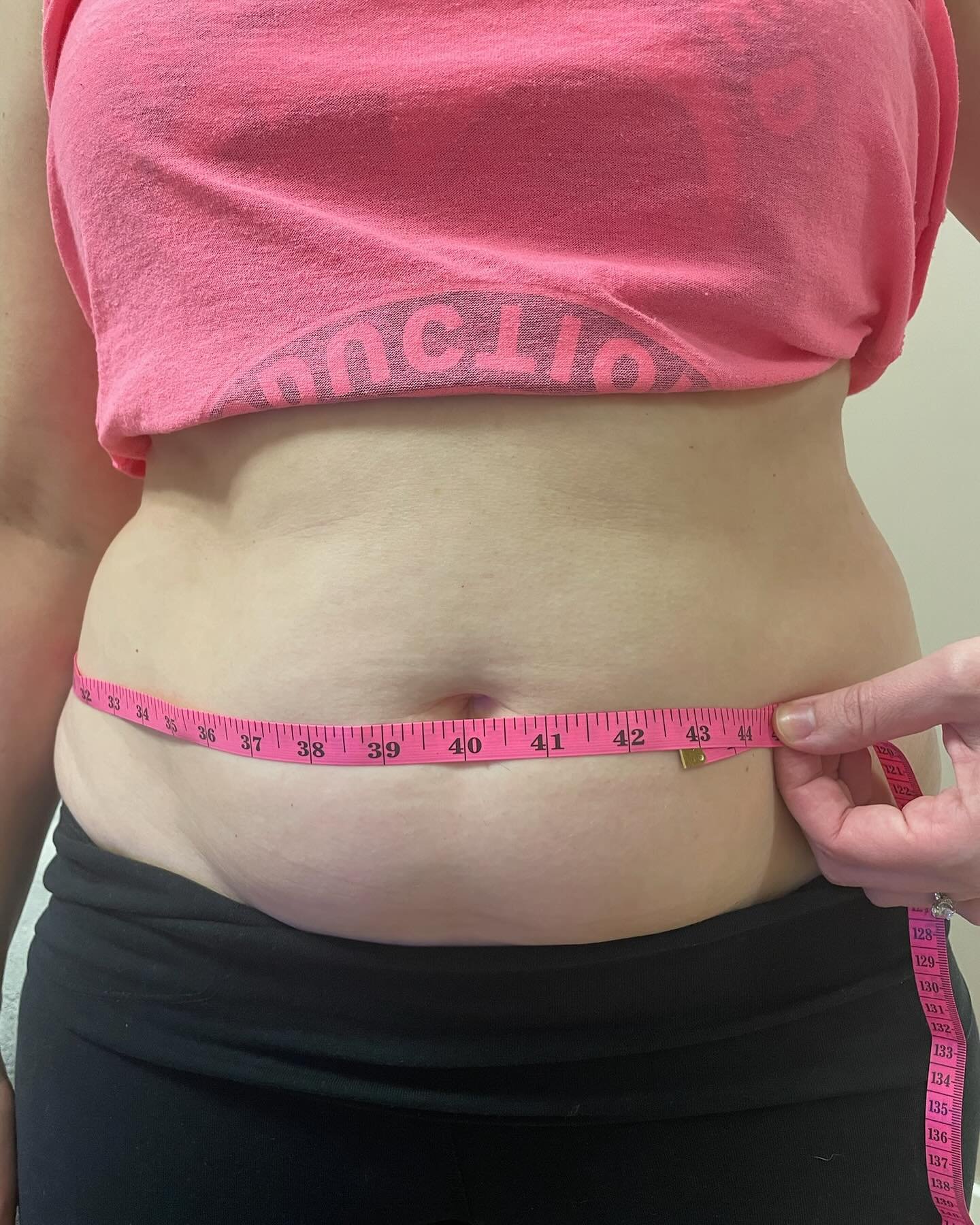 Same client, same day. Down just over an inch after doing our Neva skin cryo-treatment!  Sculpt. Tighten. Refresh. 
Neveskin Cryo-Treatment isn&rsquo;t just cold&mdash;it&rsquo;s cutting-edge. ❄️🔥

Targeting the stomach area, this non-invasive thera