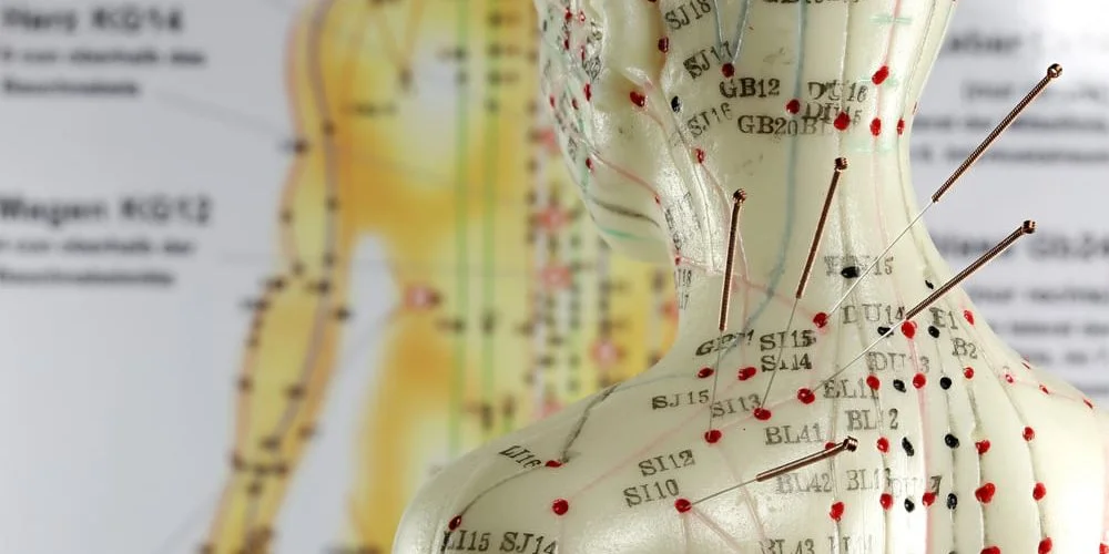 How To Know When Acupuncture Is Working