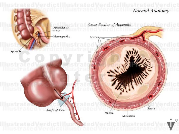 Normal Size Of Appendix Stock Appendix: Normal Anatomy — Illustrated Verdict