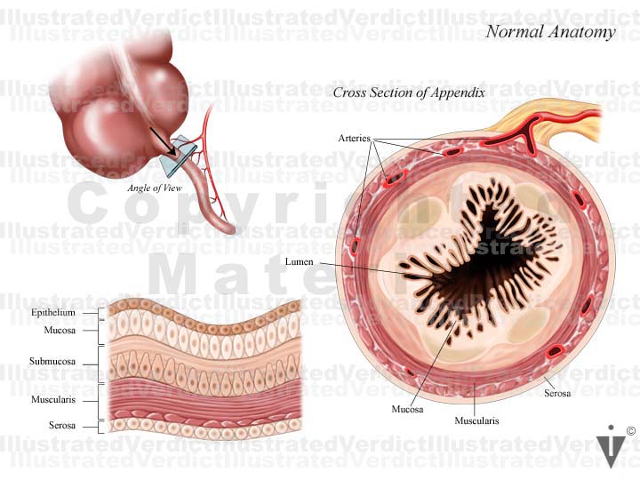 Normal Size Of Appendix Stock Appendix: Normal Anatomy — Illustrated Verdict