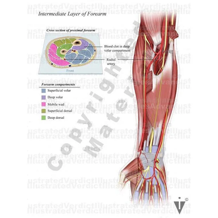 Normal Arm Shape Stock Arm: Normal Anatomy — Illustrated Verdict