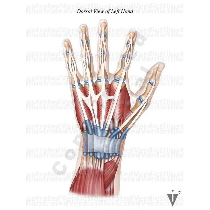 Stock Arm: Normal Anatomy — Illustrated Verdict