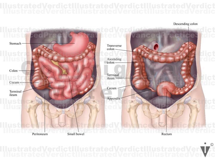Stock Bowel: Normal Anatomy — Illustrated Verdict