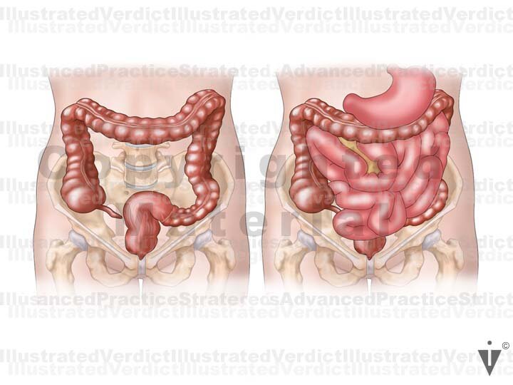 Normal Intestinal Images Stock Bowel: Normal Anatomy — Illustrated Verdict