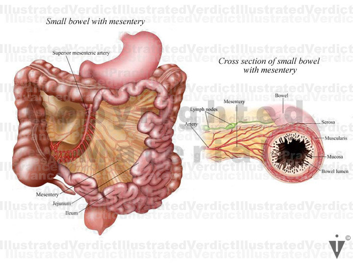 Stock Bowel: Normal Anatomy — Illustrated Verdict
