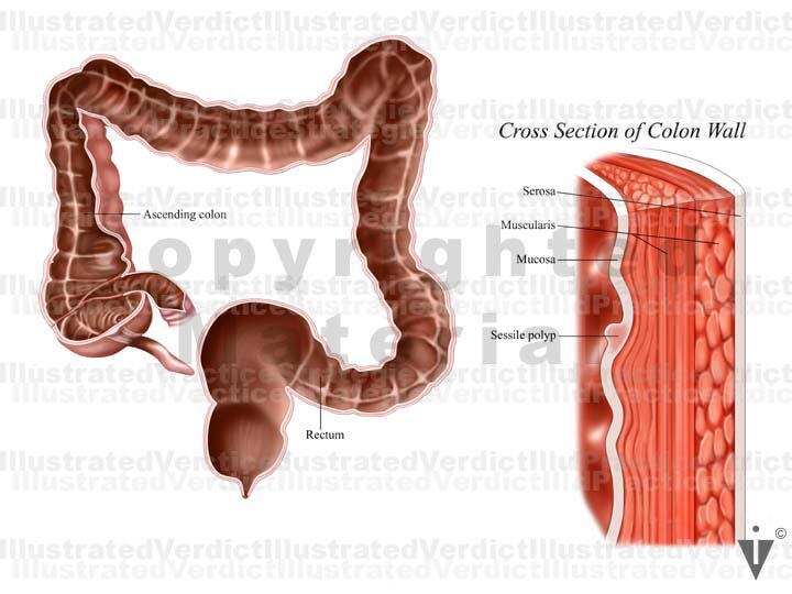 Nice Normal Colon Stock Colon: Normal Anatomy — Illustrated Verdict