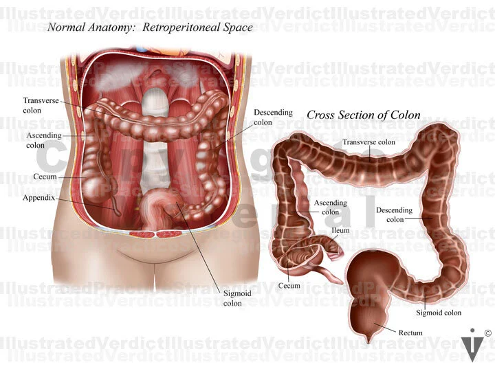 Stock Colon: Normal Anatomy — Illustrated Verdict