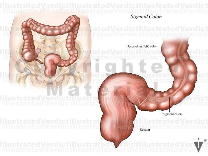 Stock Colon: Normal Anatomy — Illustrated Verdict