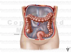 Stock Colon: Normal Anatomy — Illustrated Verdict