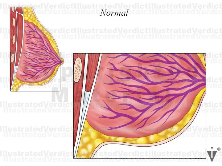 Stock Breast: Normal Anatomy — Illustrated Verdict