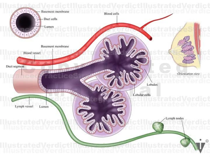 Stock Breast: Normal Anatomy — Illustrated Verdict