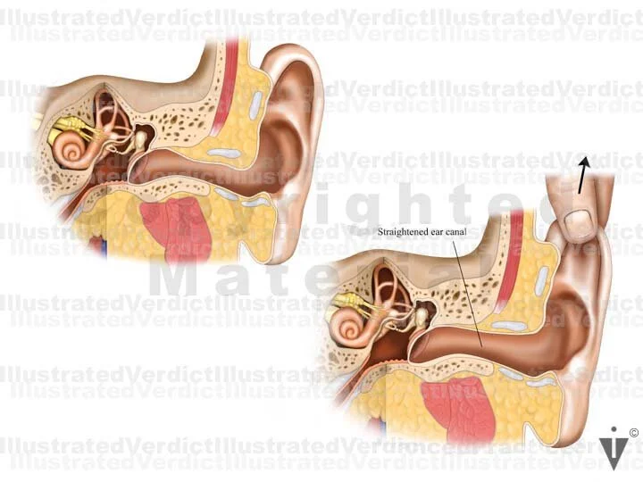 Normal Inner Ear Picture Stock Ear: Normal Anatomy — Illustrated Verdict