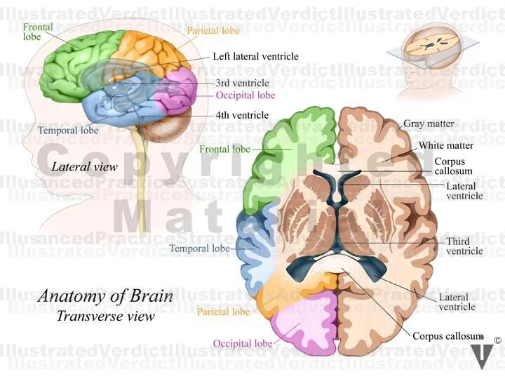 Stock Baby: Brain Normal Anatomy — Illustrated Verdict