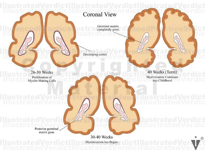 Stock Baby: Brain Normal Anatomy — Illustrated Verdict