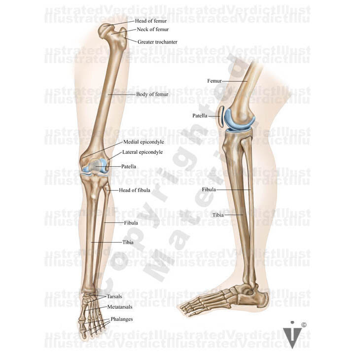 Stock Lower Limb: Orthopedic — Illustrated Verdict